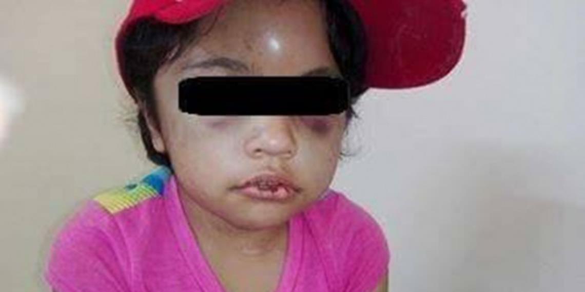 Niña de siete años es golpeada cruelmente por sus padres