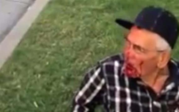 Golpean brutalmente a anciano mexicano en EU; ‘regresa a tu país’, le gritan
