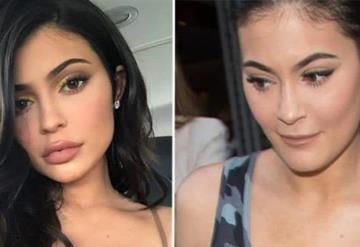 Kylie Jenner reaparece sin relleno en los labios y luce irreconocible