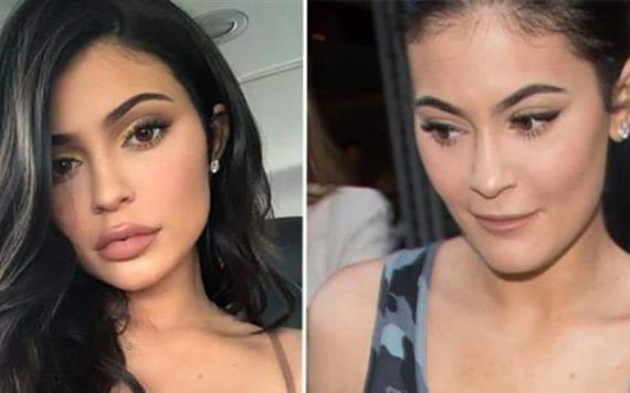 Kylie Jenner reaparece sin relleno en los labios y luce irreconocible