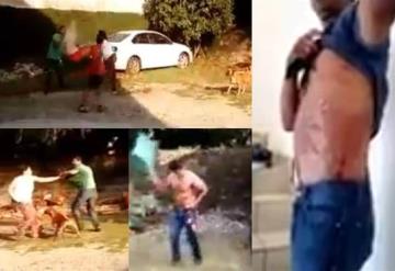 Mujer explota contra su pareja por separación y ¡le prende fuego!