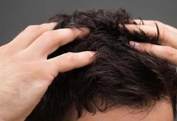 Se tiñe el pelo y alergia deforma su rostro