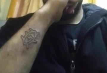 Se quita tatuaje con rallador de queso porque no le gustó