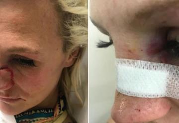 Peleadora de MMA es golpeada por su novio por querer terminar con él