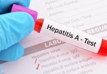 Detectan brote de hepatitis A; hay 15 afectados