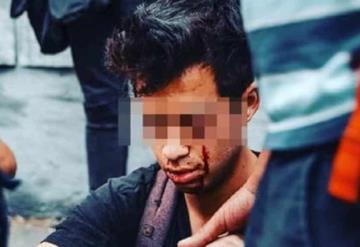 Fotógrafo quedó ciego por un balín en su ojo en protestas en Chile