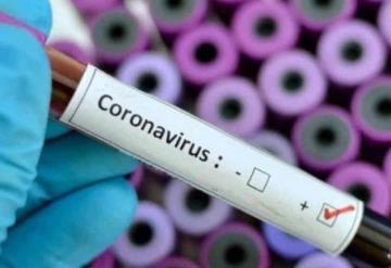 Coronavirus obliga a cancelar conciertos masivos