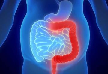 ¿Sufres colitis? así puedes reducir molestias y evitar que empeore