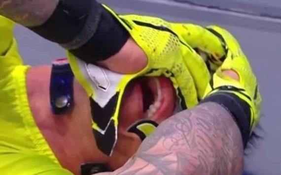 VIDEO: Rey Mysterio pierde el ojo durante pelea