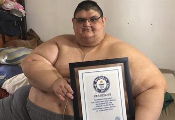 Juan Pedro, el mexicano más obeso del mundo vence al COVID-19