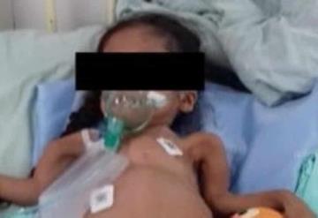 La pequeña Yoselin, internada en el Hospital del Niño, necesita ayuda