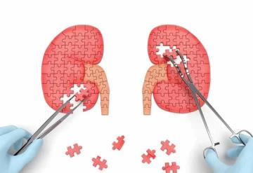 Reglas para la salud de los riñones y prevenir la enfermedad renal crónica