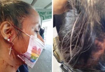 Golpean a comerciantes LGBT+ en tianguis de CDMX