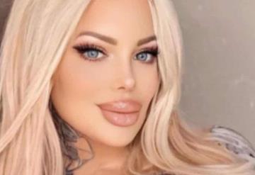 Sabrina Sabrok pierde parcialmente la movilidad de su rostro tras uso de bótox