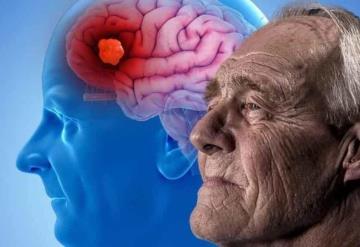 Estos son algunos mitos comunes sobre el Alzheimer que son falsos