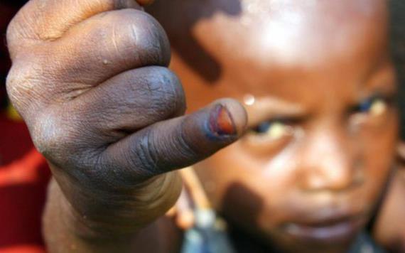 Reaparece en África virus salvaje de polio, países se encuentran en peligro