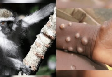 Reportan casos en Inglaterra de virus del mono de África