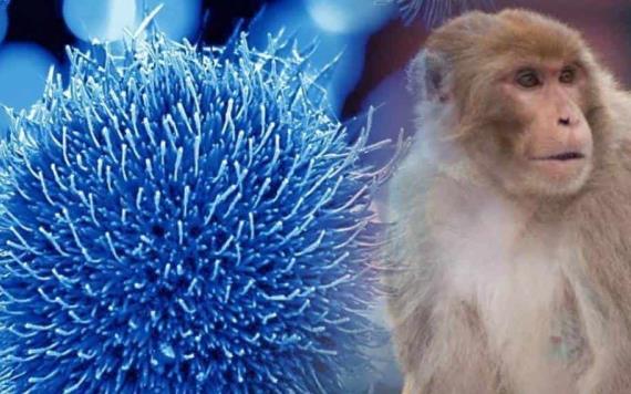 Sinaloa reporta primer caso de viruela del mono; paciente viajó a CDMX