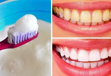 ¿Quieres dientes blancos? Cuidado con los remedios caseros