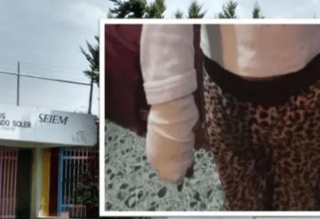 Amputan dedo a niño en escuela preescolar en Cuautepec