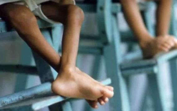 ONU omite informar sobre casos de desnutrición infantil en Venezuela