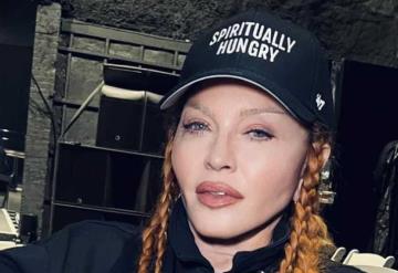 Madonna presume su rostro desinflamado tras críticas; miren lo linda que estoy