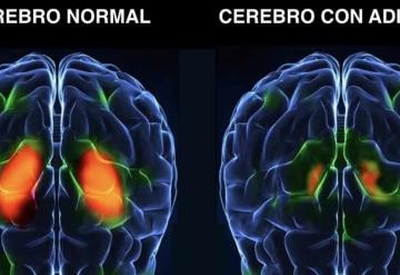 El cerebro y la adicción